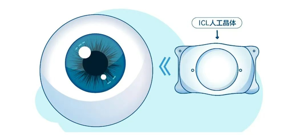 图片.png 图片.png